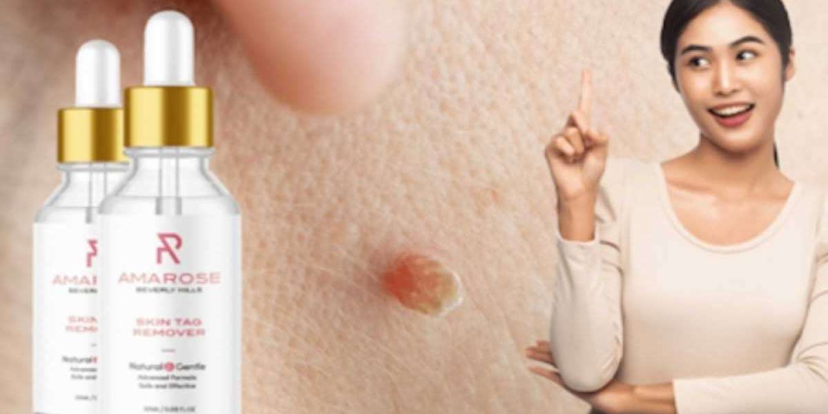 Amarose Skin Tag Remover : Where you can purchase the product?