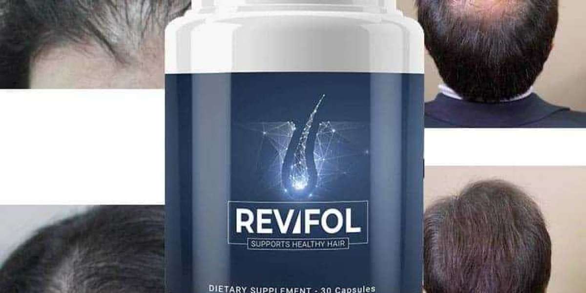 Revifol Reviews – Does It Really Work For Hair Loss?
