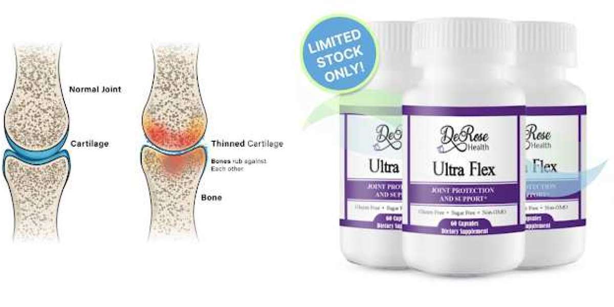 Ultra Flex Price - Try Best Results For Joint Pain Relief