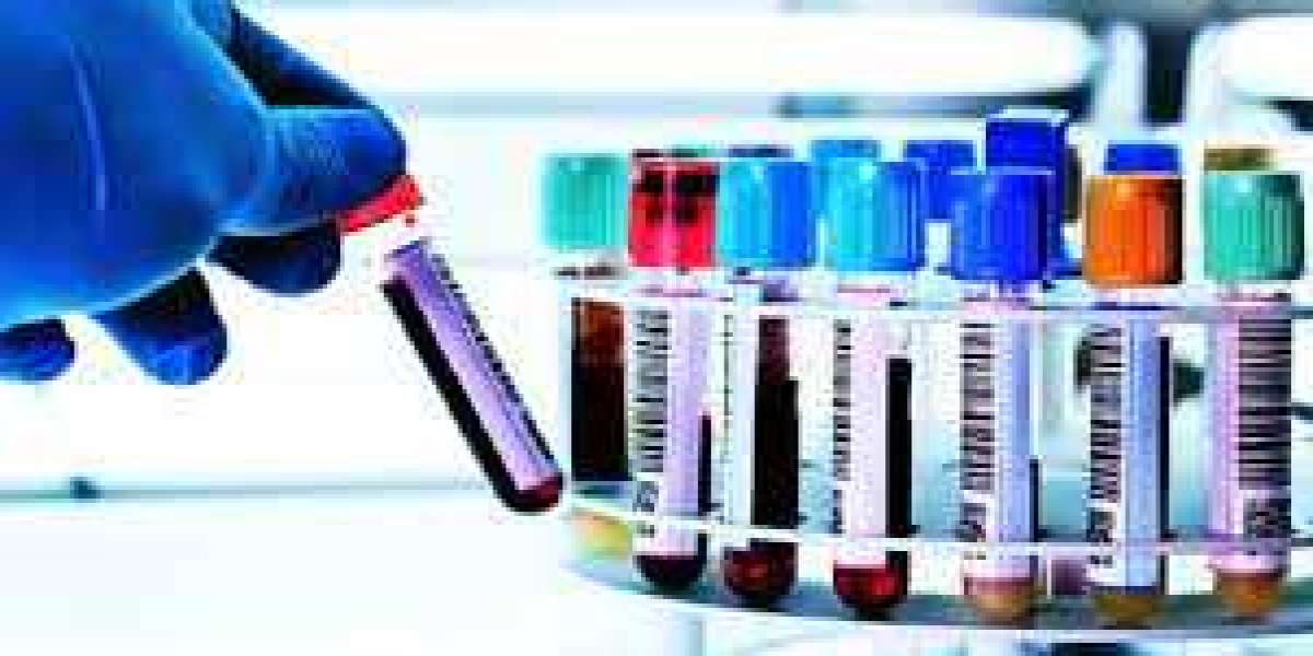 Clinical Laboratory Tests Market 2023 Overview, Growth Forecast, Demand and Development Research Report to 2031